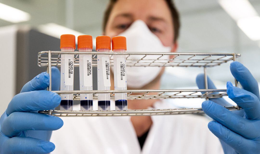 Un científico sostiene varias muestras de test de Covid-19.