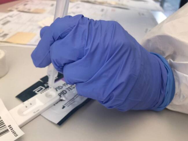 Este lunes se han notificado dos nuevos positivos por coronavirus