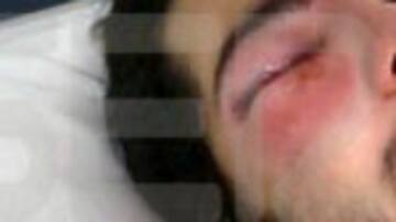 "NUESTRA LUCHA, CONTRA LAS PELOTAS DE GOMA"