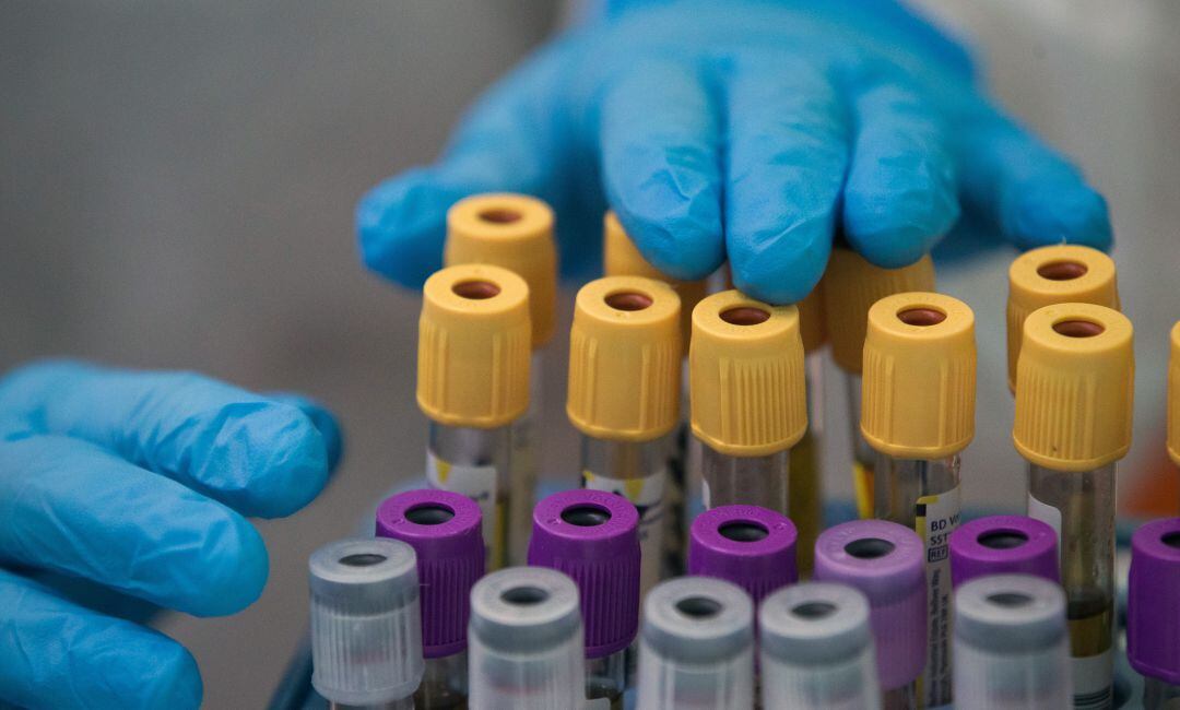 Pruebas COVID en una imagen reciente