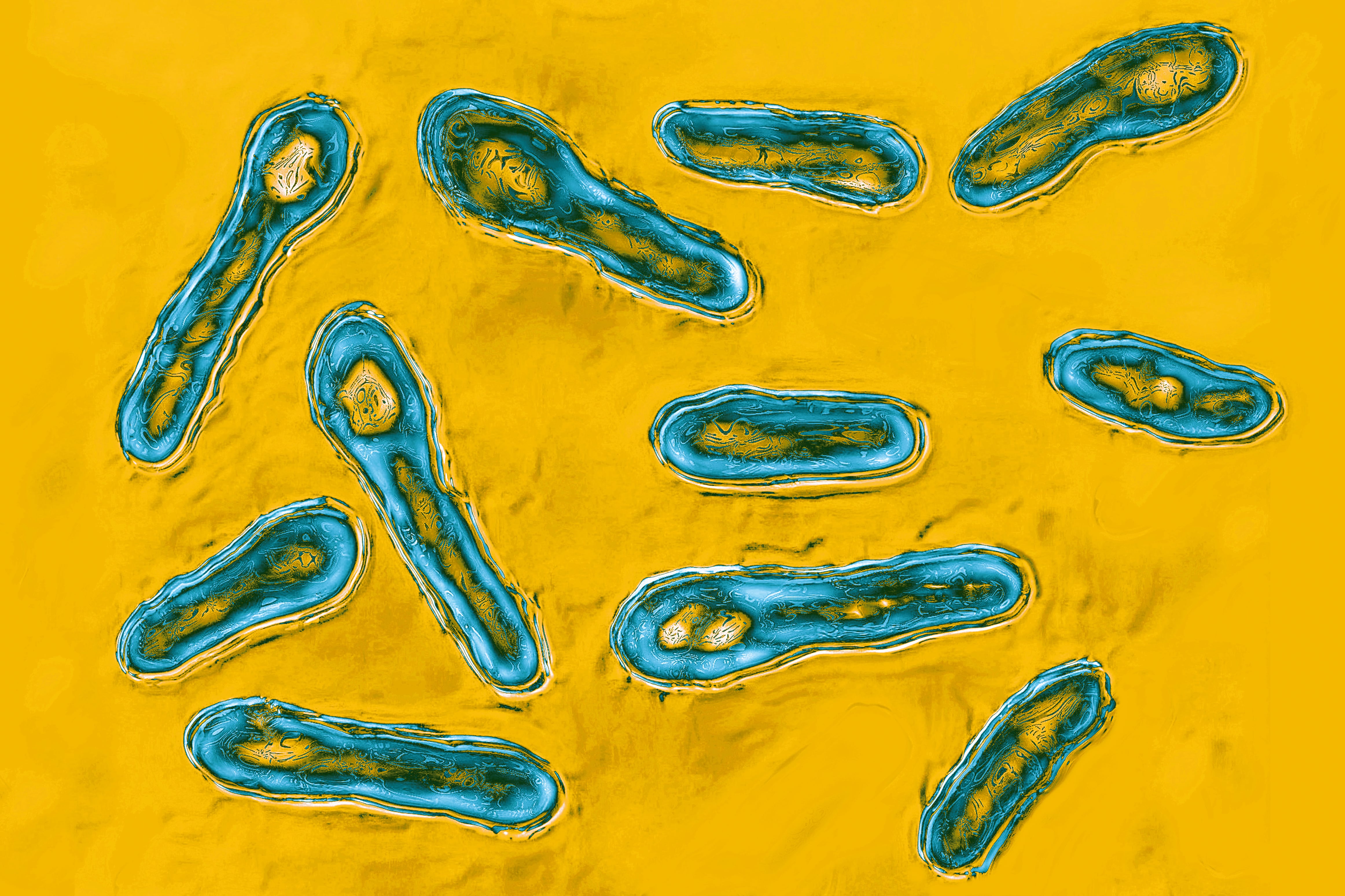 La bacteria clostridium botulinum produce la toxina del botulismo.