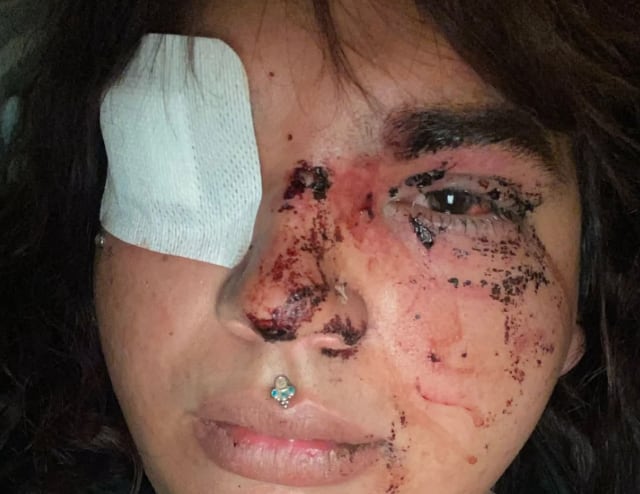 Una mujer transexual sufre una paliza a manos de un grupo de personas en La Bañeza (León).