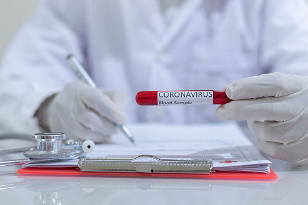 Análisis de coronavirus