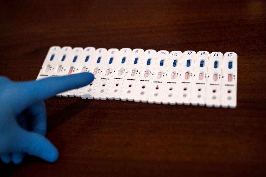 Test de diagnostico de la COVID-19.
