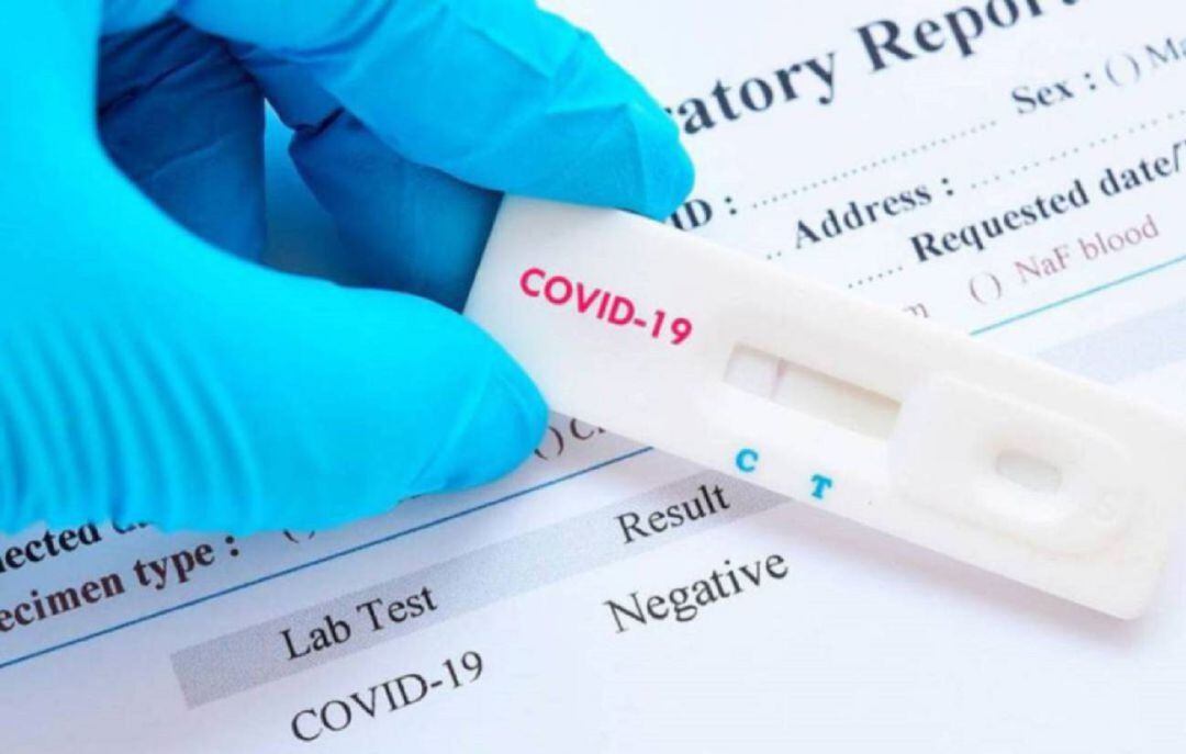 Realización de un test de coronavirus.