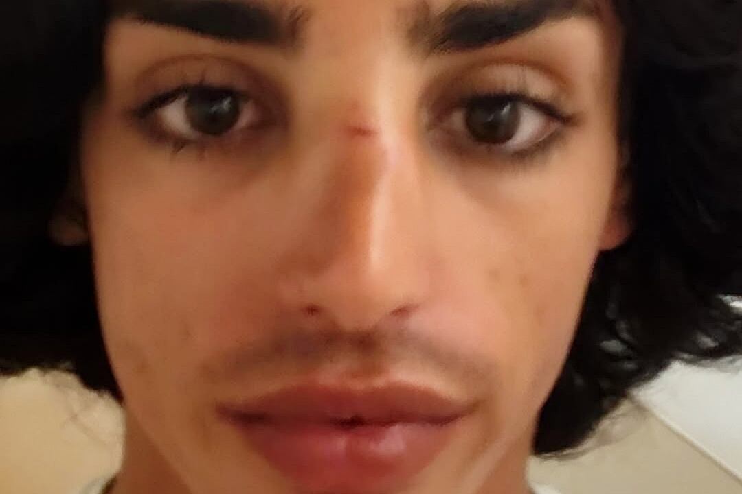 Agresión homófoba en Alicante