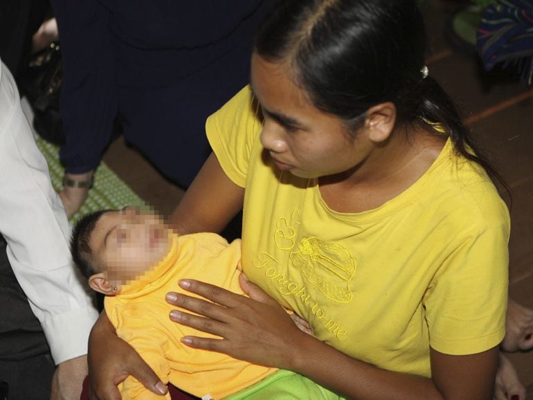 Una joven vietnamita sostiene en brazos a su hija de cuatro meses con microcefalia vinculada a un contagio del virus del zika durante su gestación. 