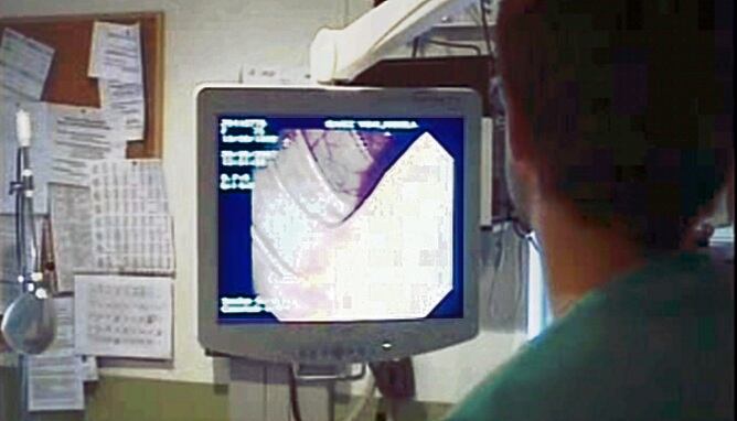 Una colonoscòpia a l&#039;Hospital Clínic de Barcelona