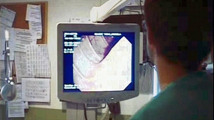 "La detección precoz del cáncer de colon mejora la calidad de vida y la supervivencia": Osakidetza amplía el cribado colorrectal hasta los 74 años