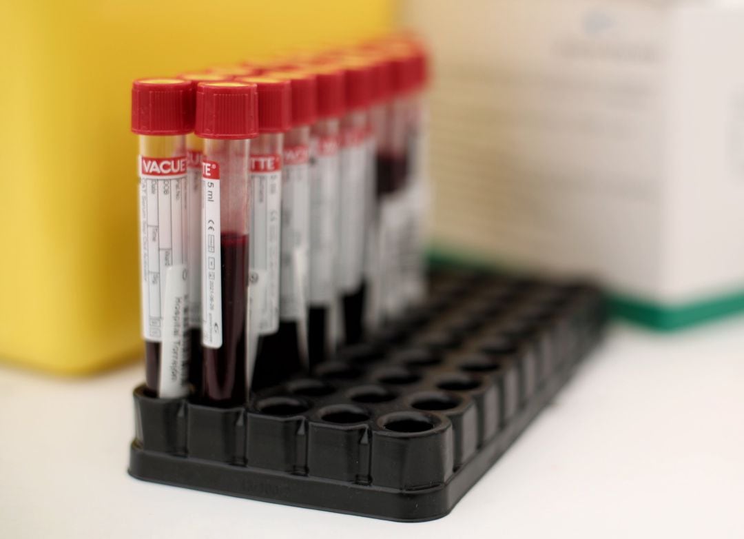 Tubos de ensayo con muestras durante la quinta jornada del test serológico masivo de coronavirus que el Ayuntamiento de Torrejón desplegó para los vecinos.
