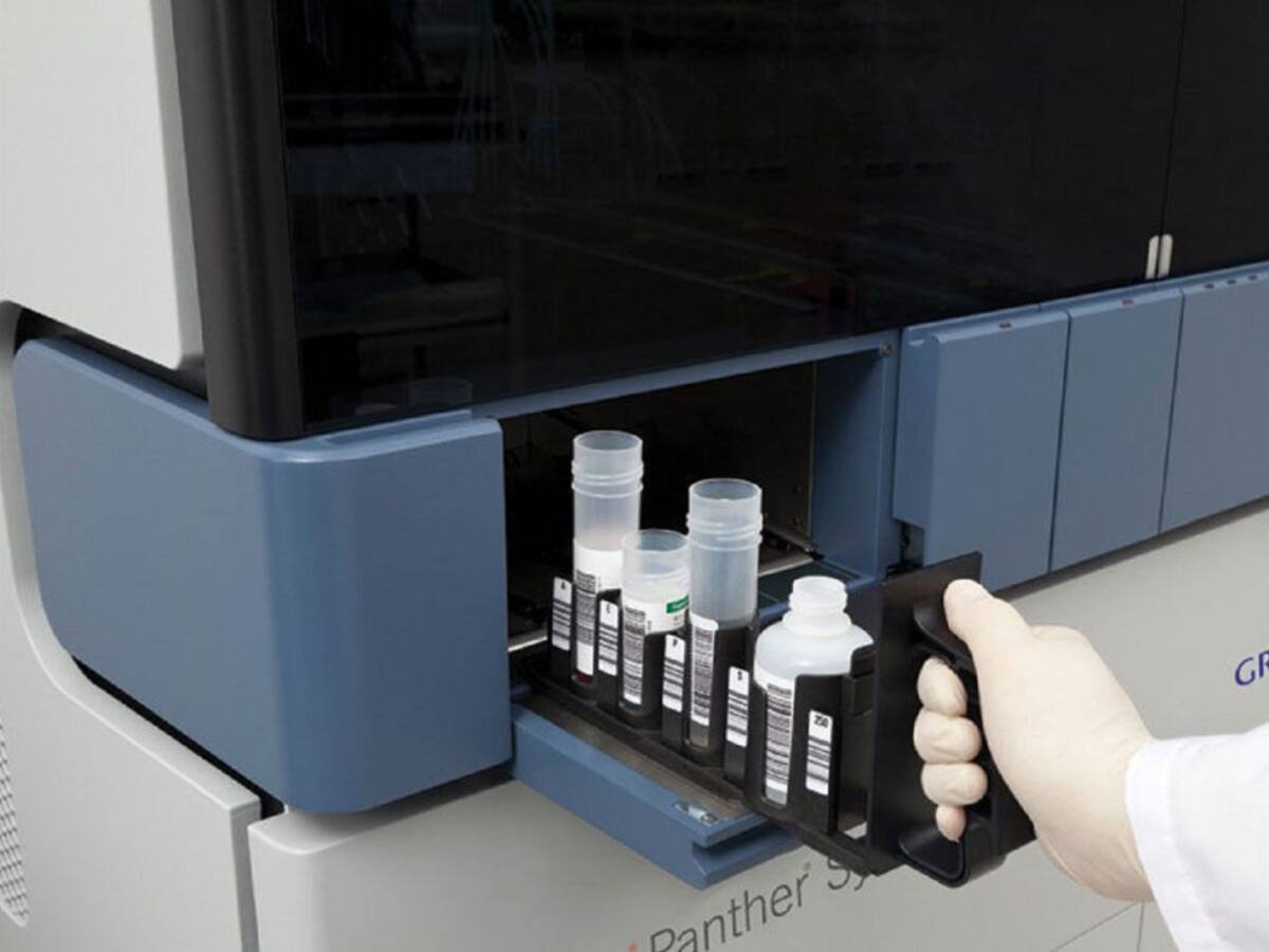 Torna a funcionar la màquina TMA avariada