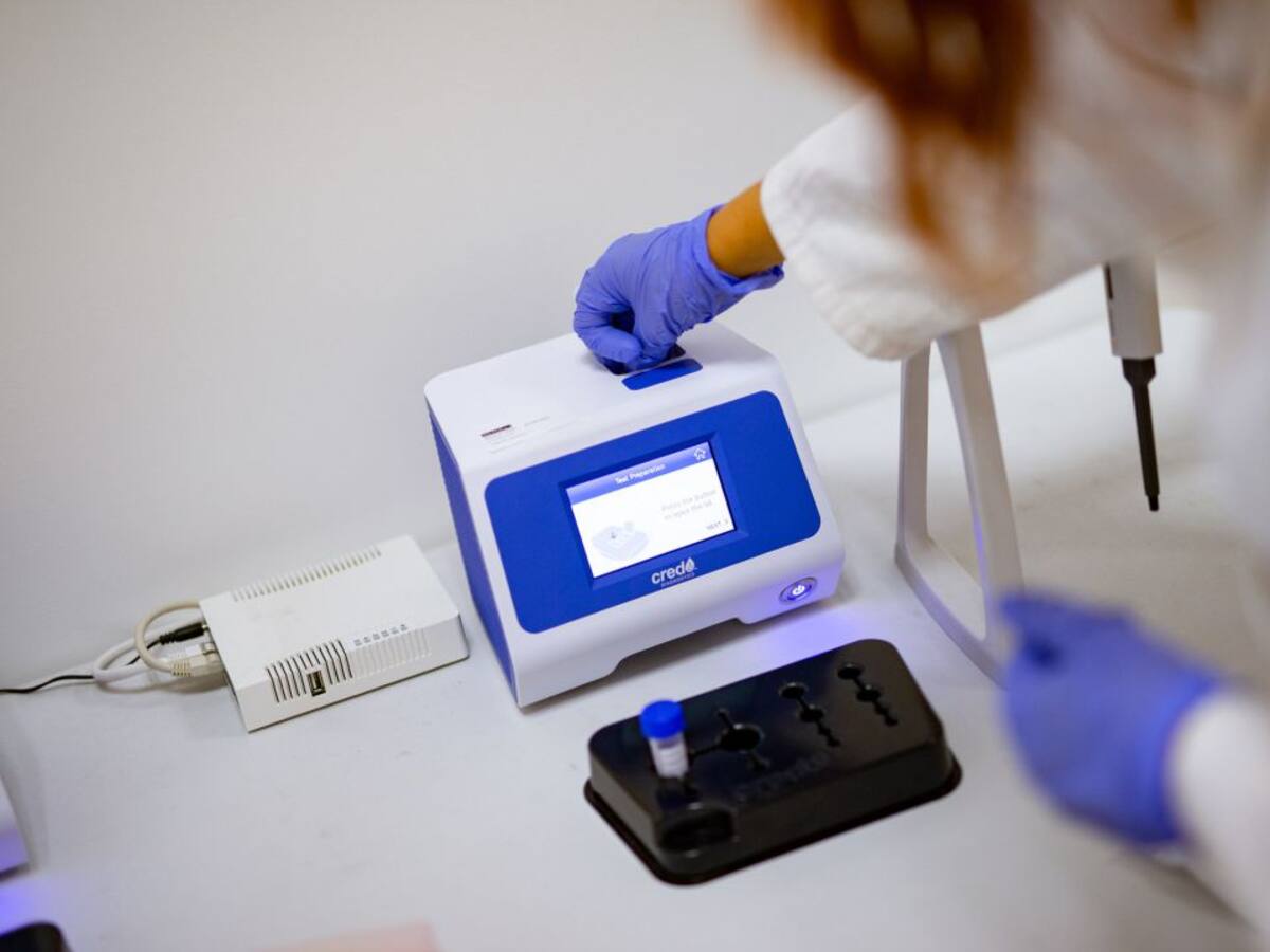 Navarra vuelve a superar los 100 casos por COVID-19