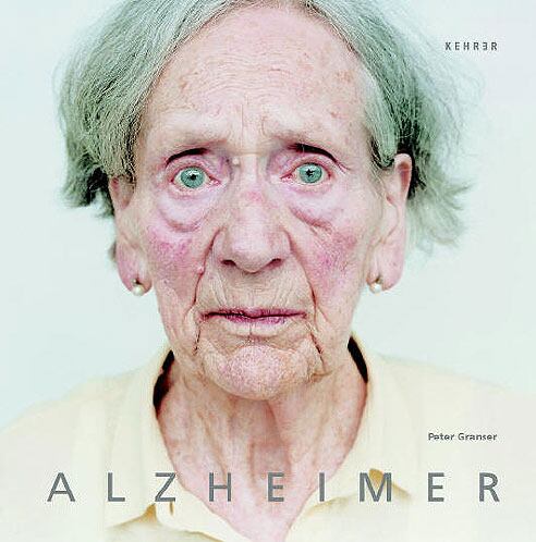 Cartel de la exposición 'Alzheimer' de Peter Granser.
