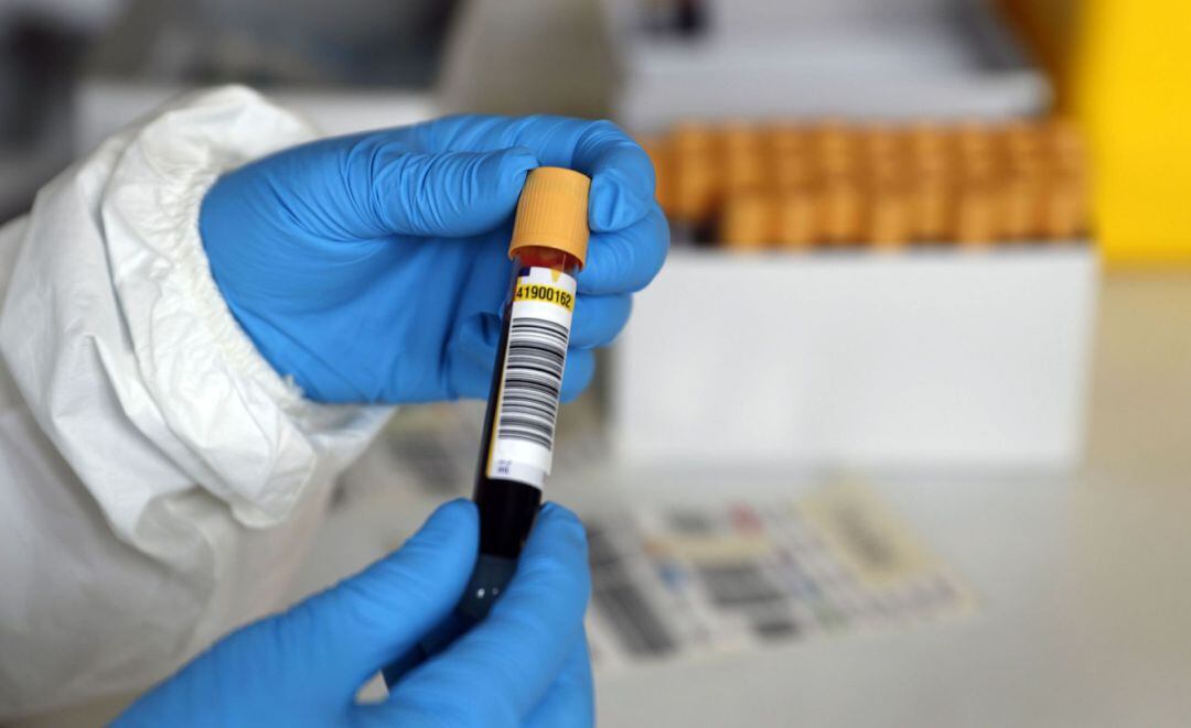 Una sanitario con la muestra de un pescador en el puerto vizcaíno de Santurtzi