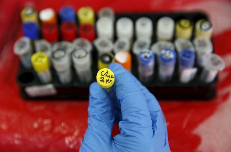 Muestras de sangre de personas contagiadas por el virus del zika en Lima, Perú