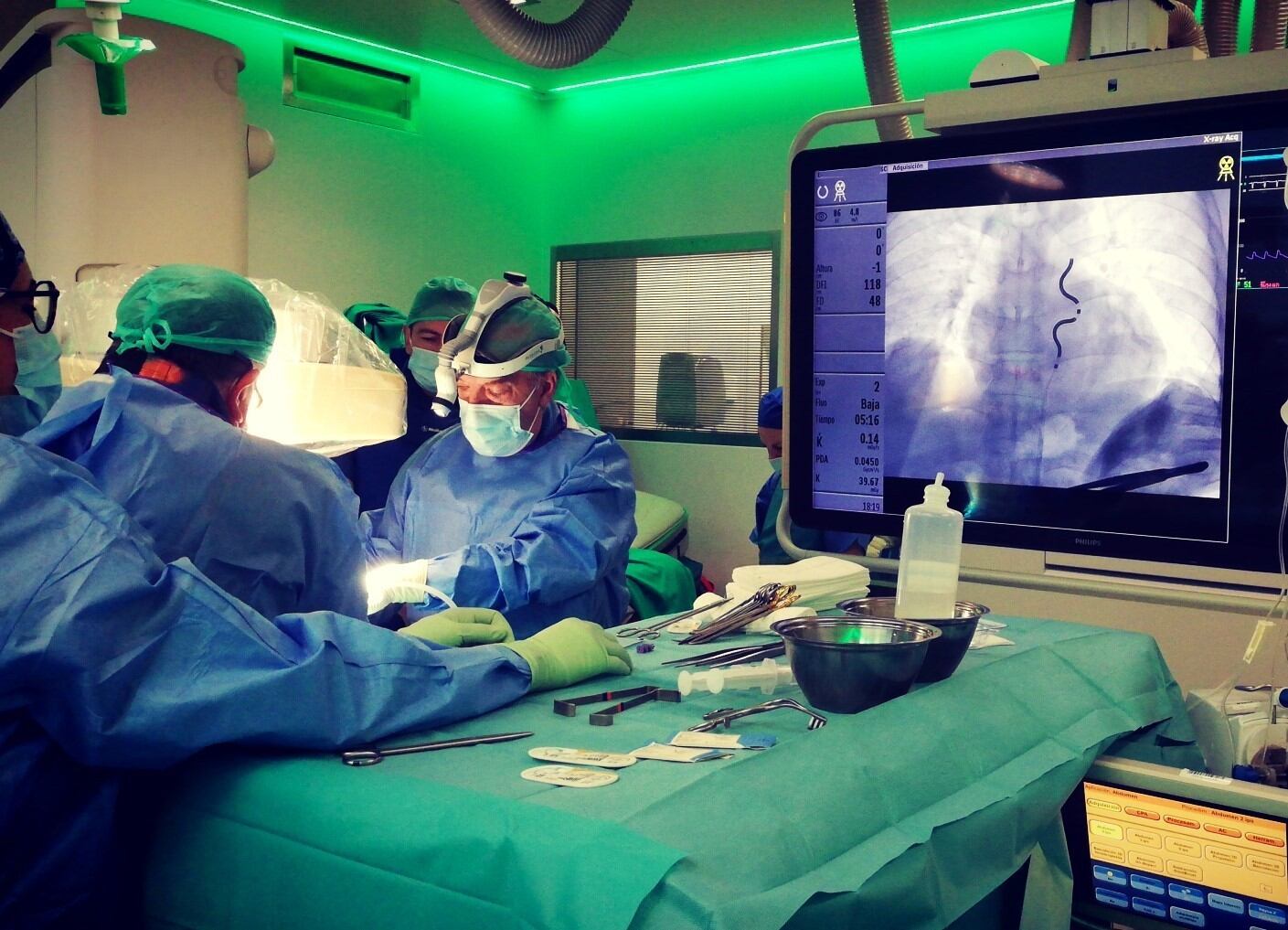 Implantación de un desfibrilador extravascular retroesternal en Quirónsalud Córdoba.