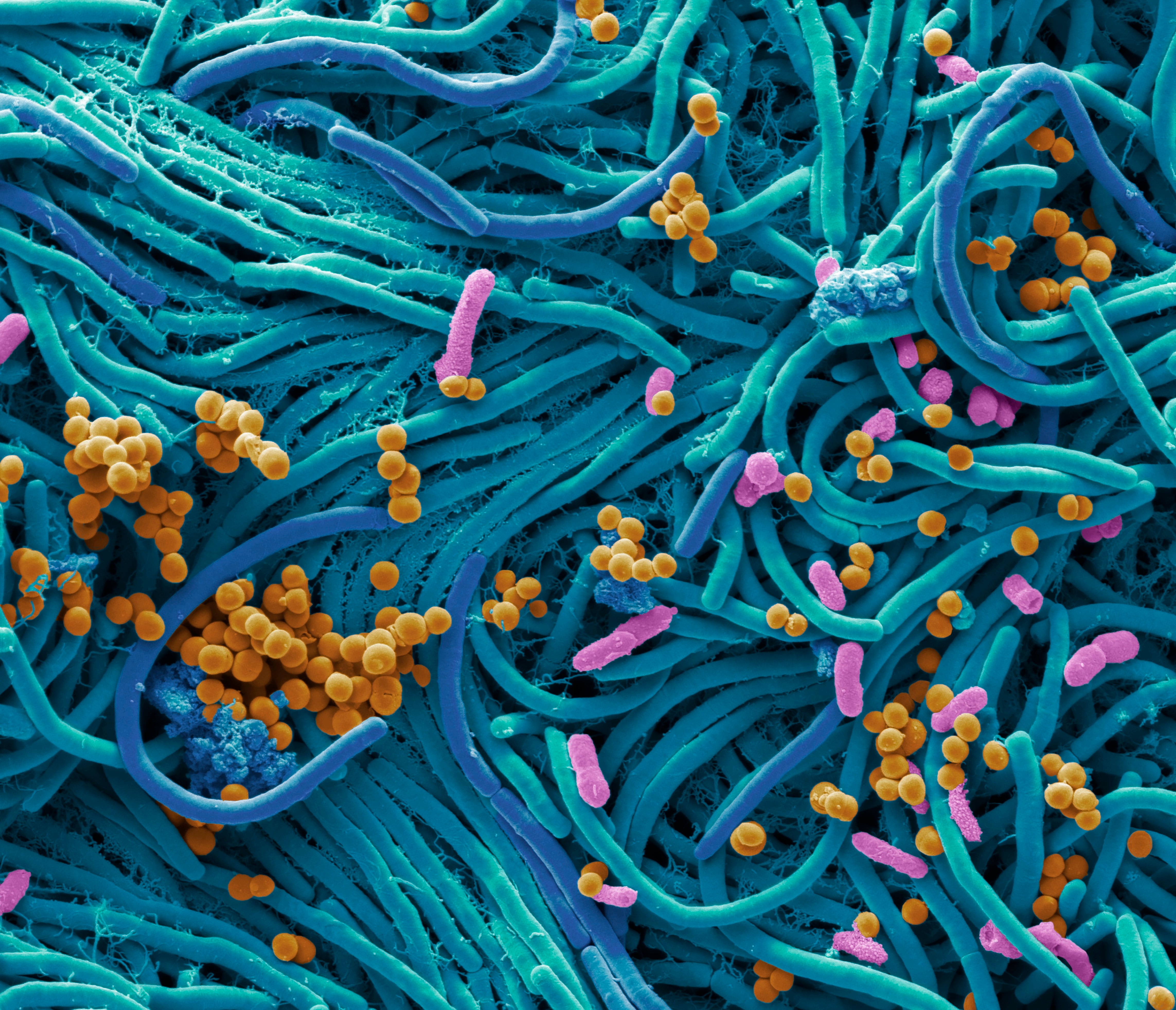 Bacteria found on mobile phone. Coloured scanning electron micrograph (SEM) of bacteria cultured from a mobile phone. Tests have revealed the average handset carries 18 times more potentially harmful germs than a flush handle in a men&#039;s toilet. With frequent use phones remain warm, creating the ideal breeding ground for bacteria. With touch-screen phones, the same part of the phone touched with fingertips is pressed up against the face and mouth, increasing chances of infection. In tests E. coli, Haemophilus influenzae and MRSA were amongst infectious bacteria found on handsets. Common harmless bacteria include Staphylococcus epidermidis, Micrococcus, Streptococcus viridans, Moraxella, and bacillus species. Magnification: x4000 when printed at 10cm wide