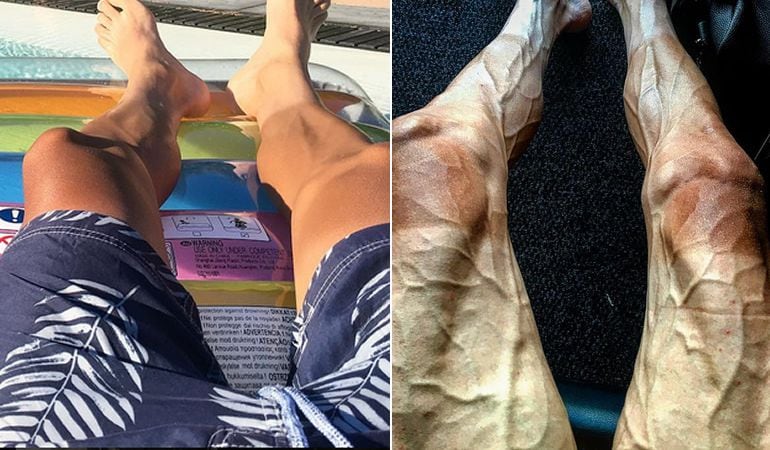 Imagen comparativa de las piernas de Pawel Poljánski durante el Tour y en otra etapa del año