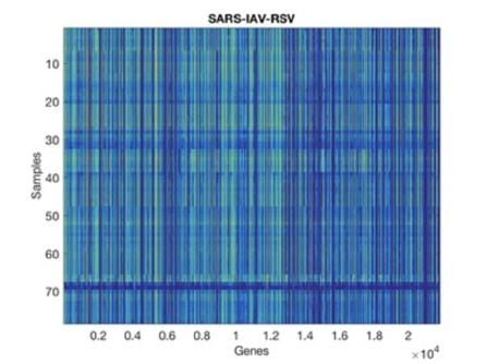 Nivel de expresión de diferentes genes en muestras infectadas por COVID, gripe A y RSV, de acuerdo a los datos del Hospital Monte Sinaí.