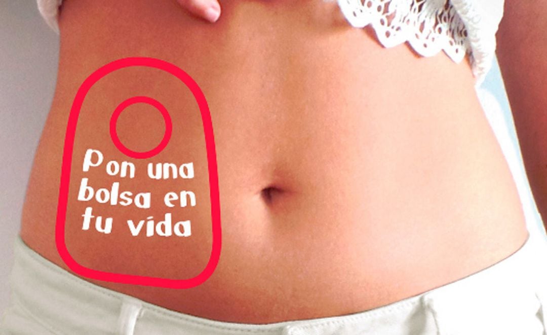 Día Mundial del Paciente Ostomizado, imagen de la campaña &quot;Pon una bolsa en tu vida&quot;