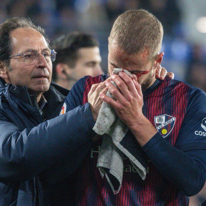 Pulido se tuvo que retirar sangrando por un fuerte golpe en la nariz ante el Andorra