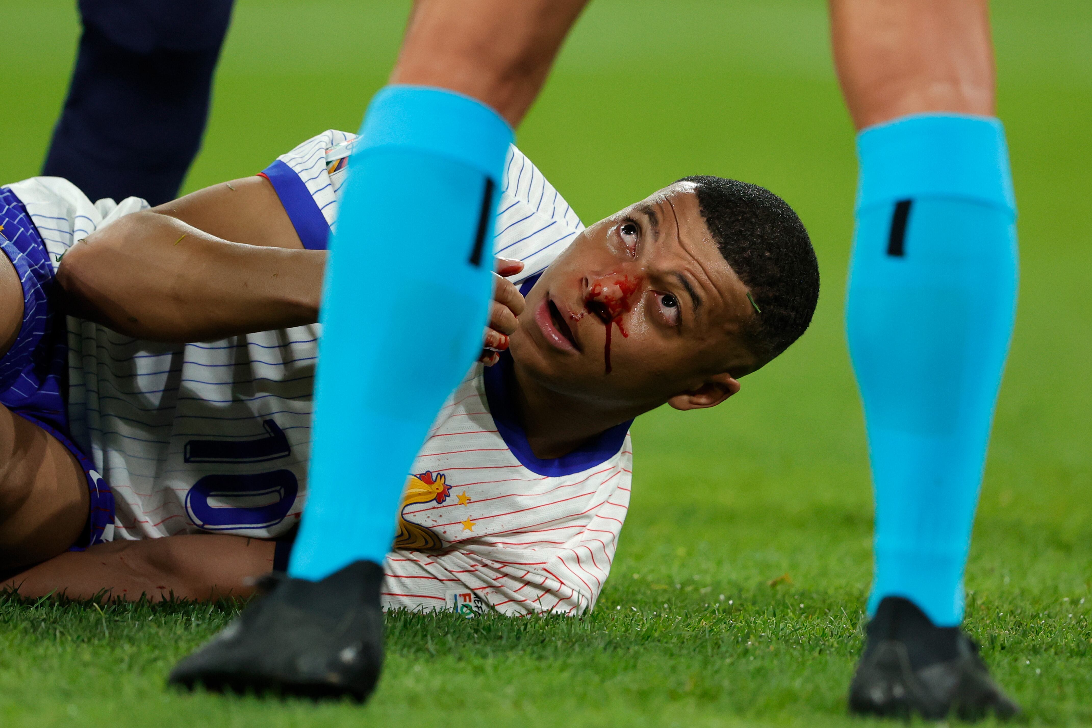 Kylian Mbappé se duele de la nariz tras un fuerte golpe contra Danso en el Austria - Francia