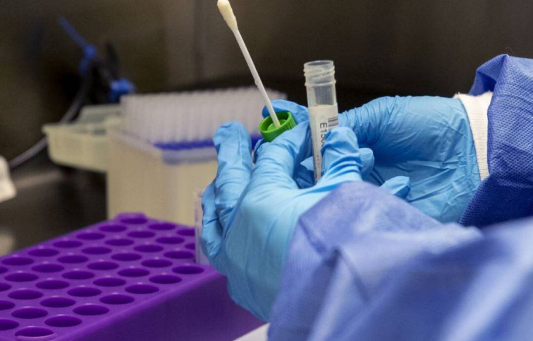 Muestra tras prueba PCR