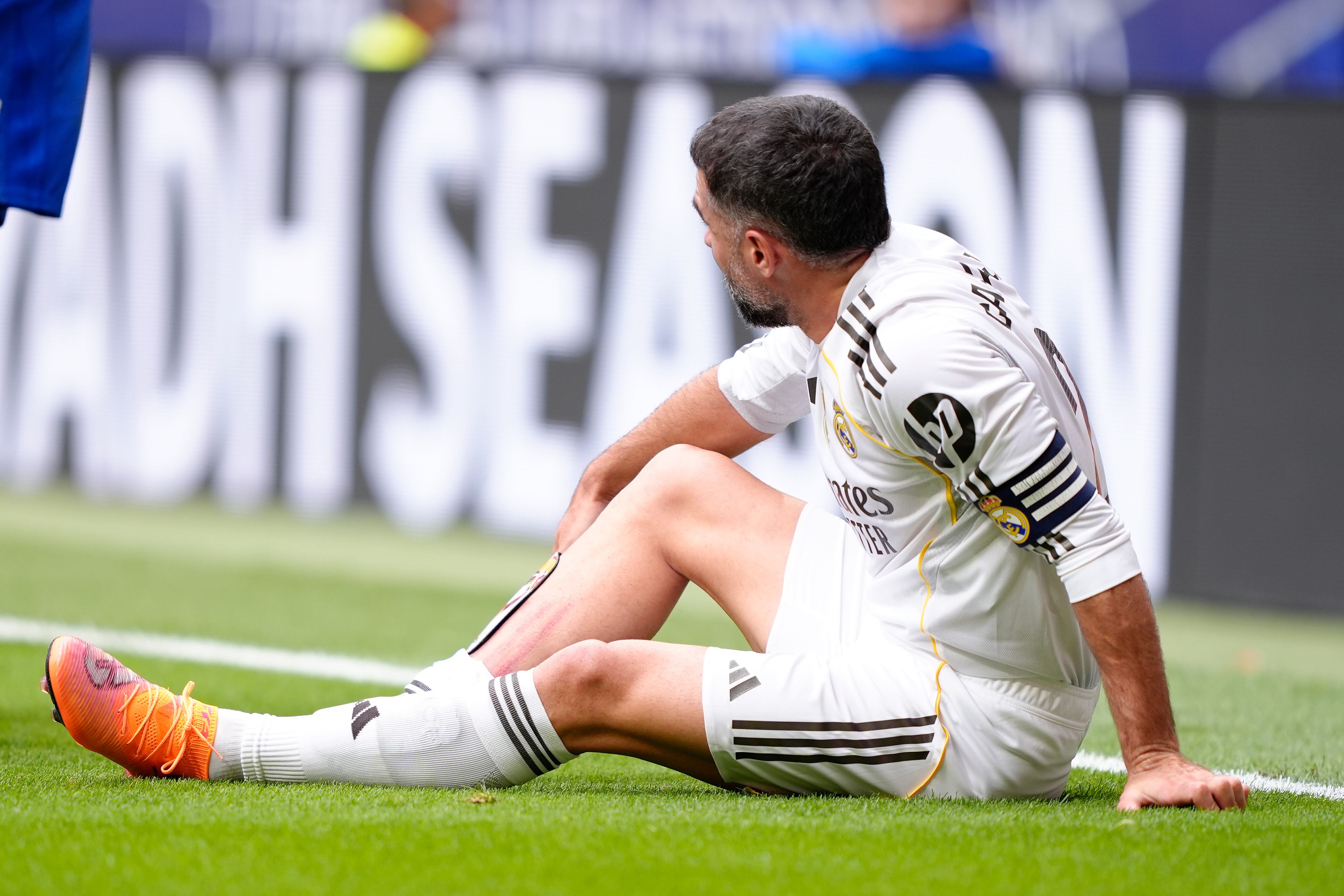 Daniel Carvajal se lesionó durante el derbi madrileño