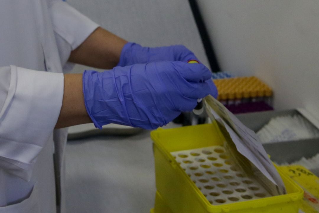 Probetas de pacientes tras la realización del test en sangre de la COVID-19.