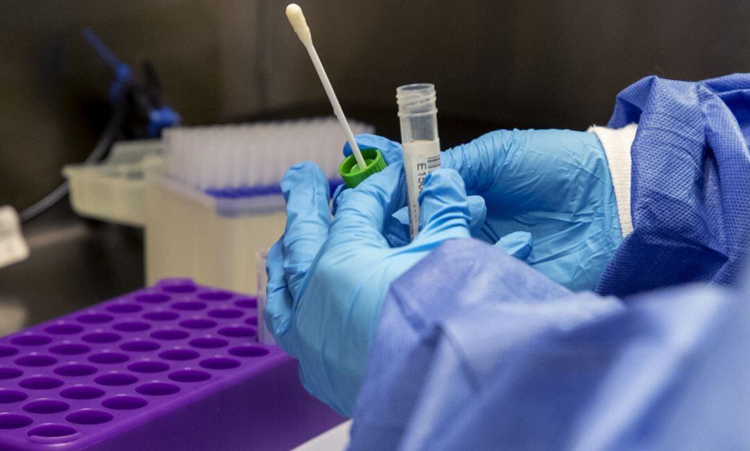 Isopo de un test PCR