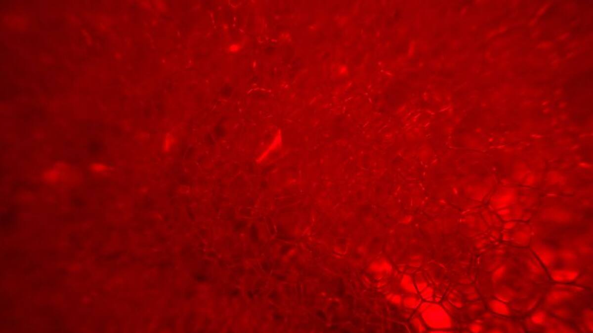 Cors Nous, l'esperança per als trasplantats de cor