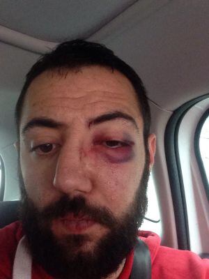Guillermo, uno de los agredidos; imagen incluída en el comunicado hecho público por la Federación de Peñas del Real Zaragoza