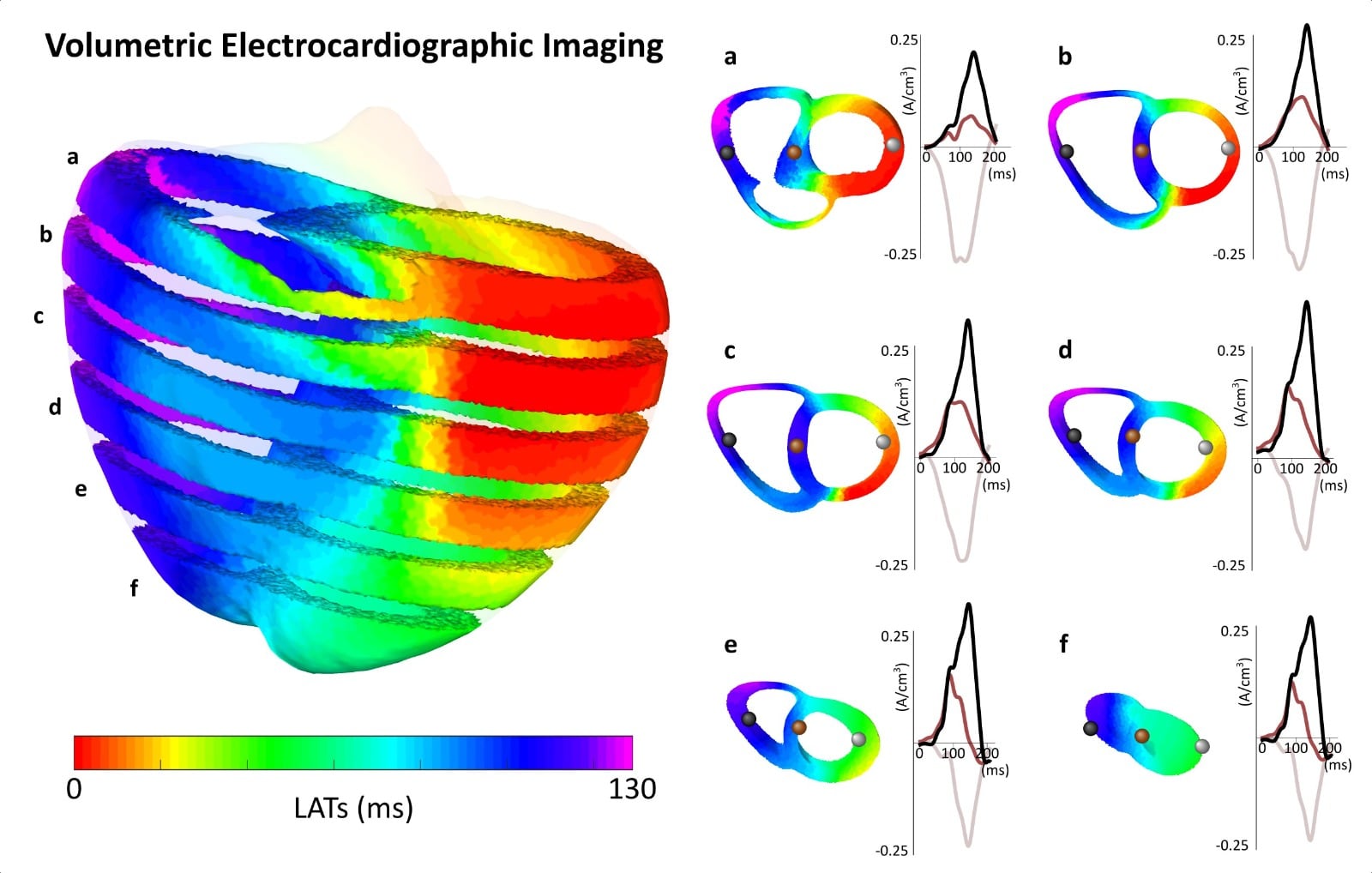 Imagen del estudio de la UPV y Corify