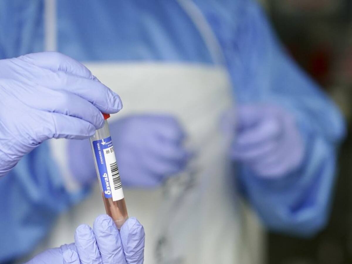 La provincia suma 74 casos, seis menos que el viernes pasado