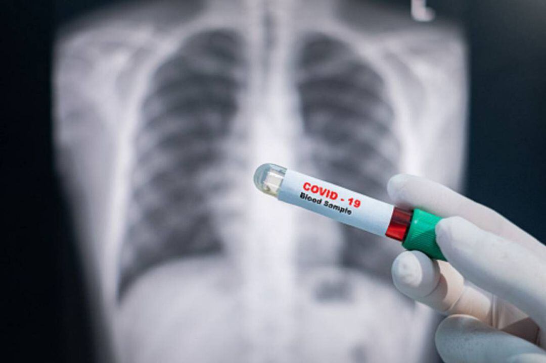 Zaragoza, del 8 al 15 de octubre, vuelve a la fase 2