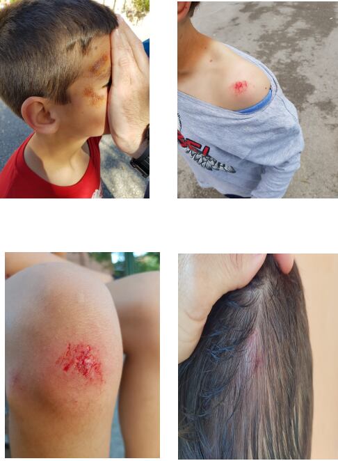 Niños heridos en el patio del CEIP de Alicante