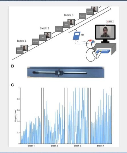 Imagen de la prueba de estimulación magnética transcraneal.