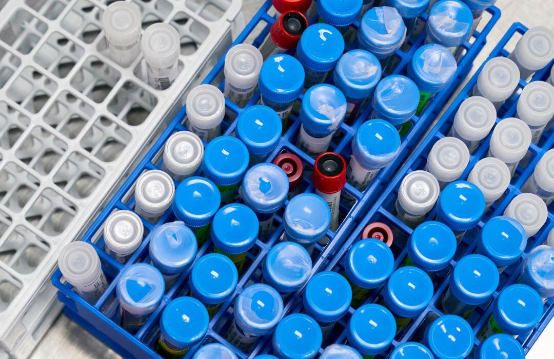 Varias muestras de test de coronavirus.