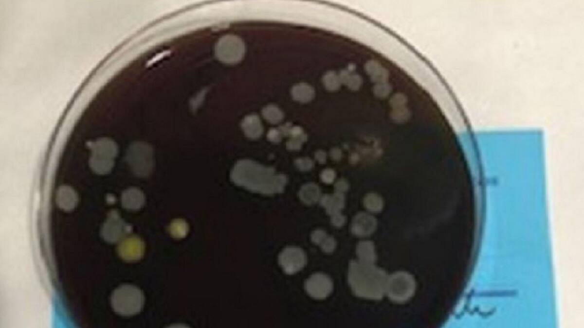 Un estudio revela que las mascarillas mal usadas pueden causar dermatitis