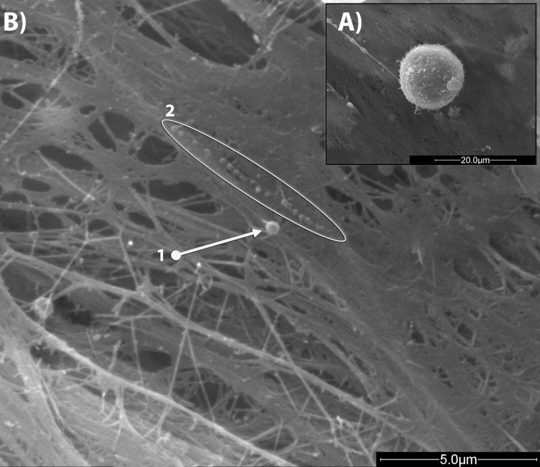 Imágenes SEM de unas célula madres mesenquimales en cultivo. B) 1. Imagen de microvesícula (diámetro 460 nm) y 2. conjunto de exosomas (diámetro medio 140nm) secretados por las células MSCs: Las imágenes se obtuvieron con un microscopio de barrido de alta resolución (HRSEM), AURIGA Carl Zeiss SMT.