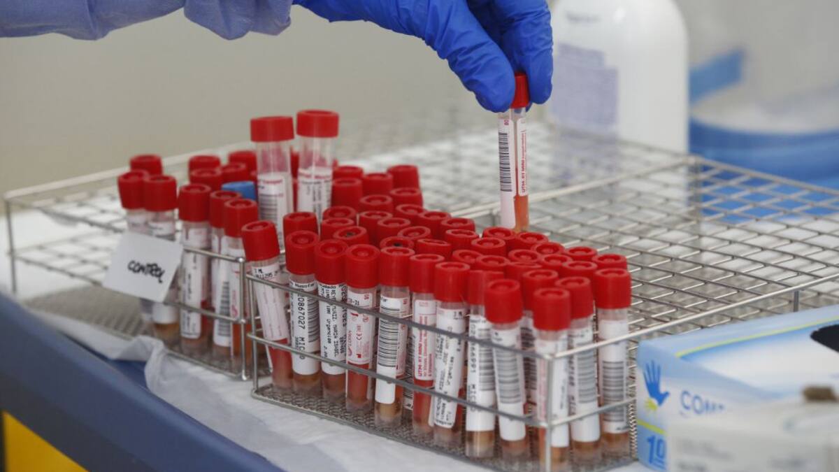 Linares anota otras tres defunciones y dos nuevos contagios por Covid19