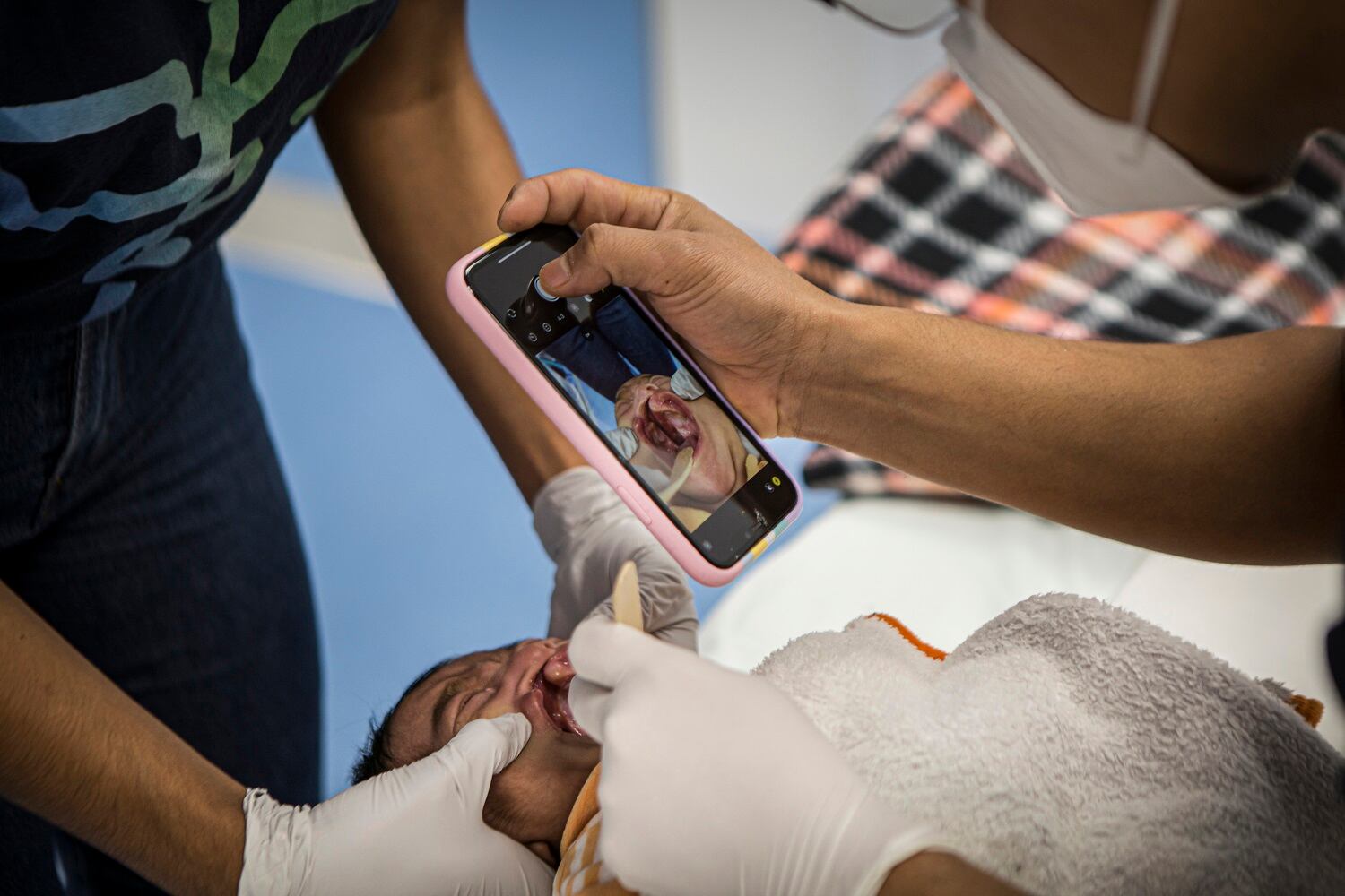 La fotoperiodista aragonesa Julia Molins vivió varios meses en Oaxaca, uno de los estados más pobres de México, para fotografiar y visibilizar una malformación que causa un gran estigma: labio y paladar hendido. Un trabajo que desarrolló gracias a la organización Mobile Surgery International