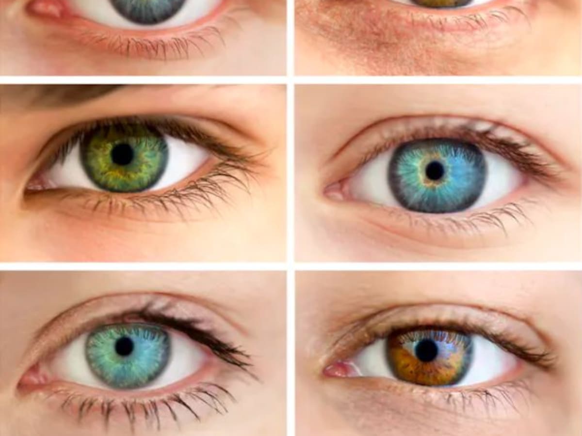Alerta dels oftalmòlegs sobre les operacions de canvi de color d'ulls - Aquí Catalunya