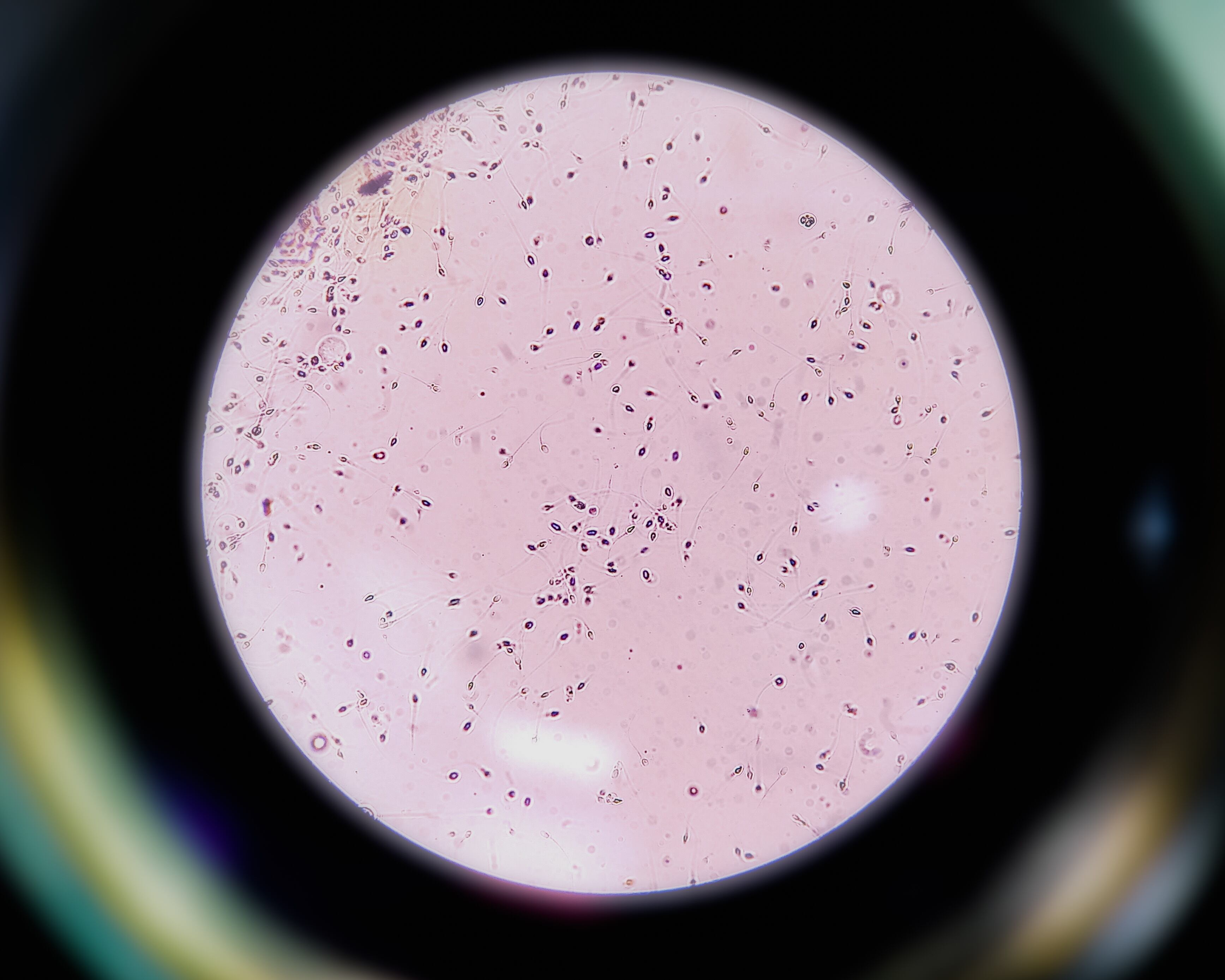 Muestra de semen visto desde el microscopio