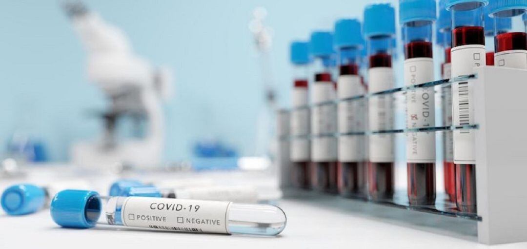 Lanzarote reduce sus casos activos por Covid-19 a 38 este lunes.