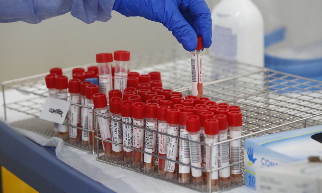 Imagen de archivo de muestras para la detección de la COVID-19 