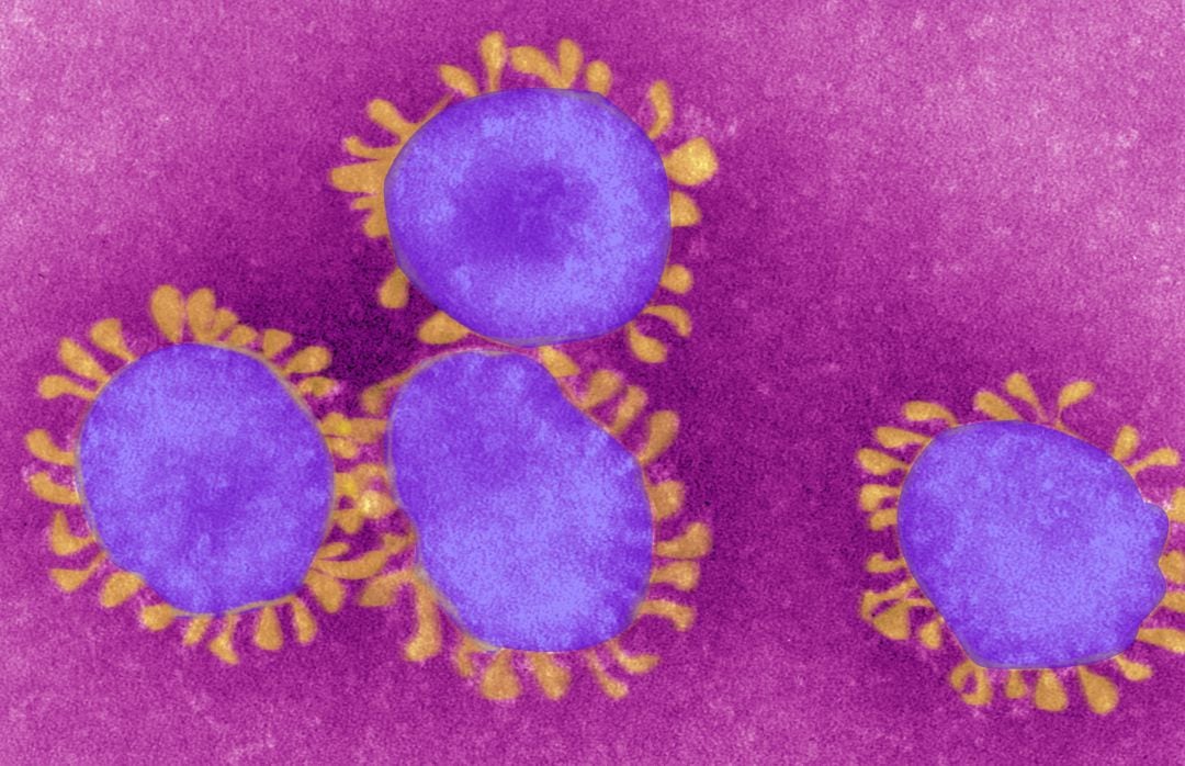 Coronavirus, a vista de microscopio.