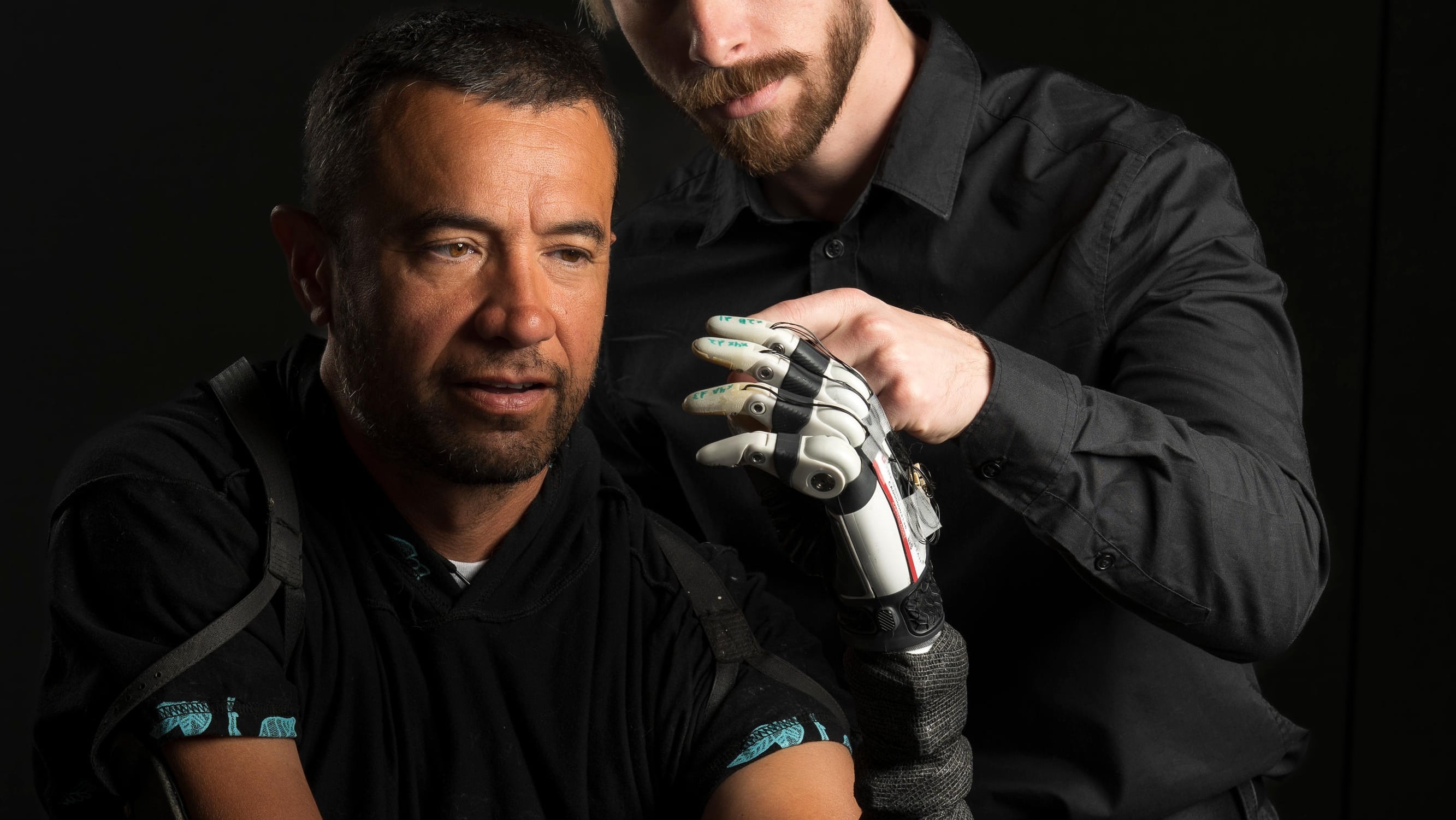 Uno de los pacientes de prueba de las manos biónicas controladas por IA.