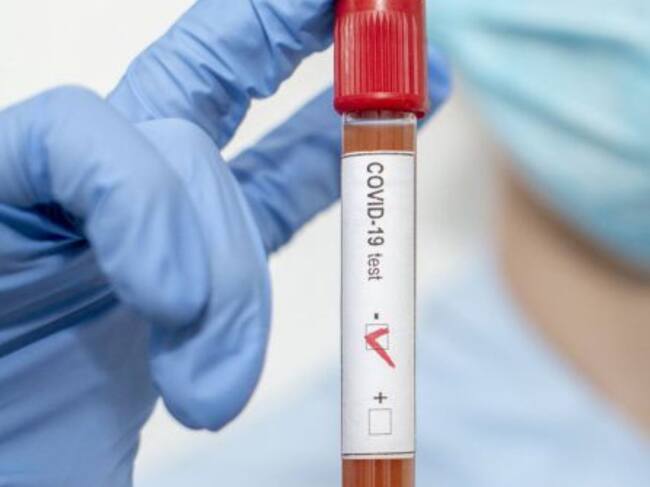 Las pruebas PCR se realizan a los contactos estrechos.