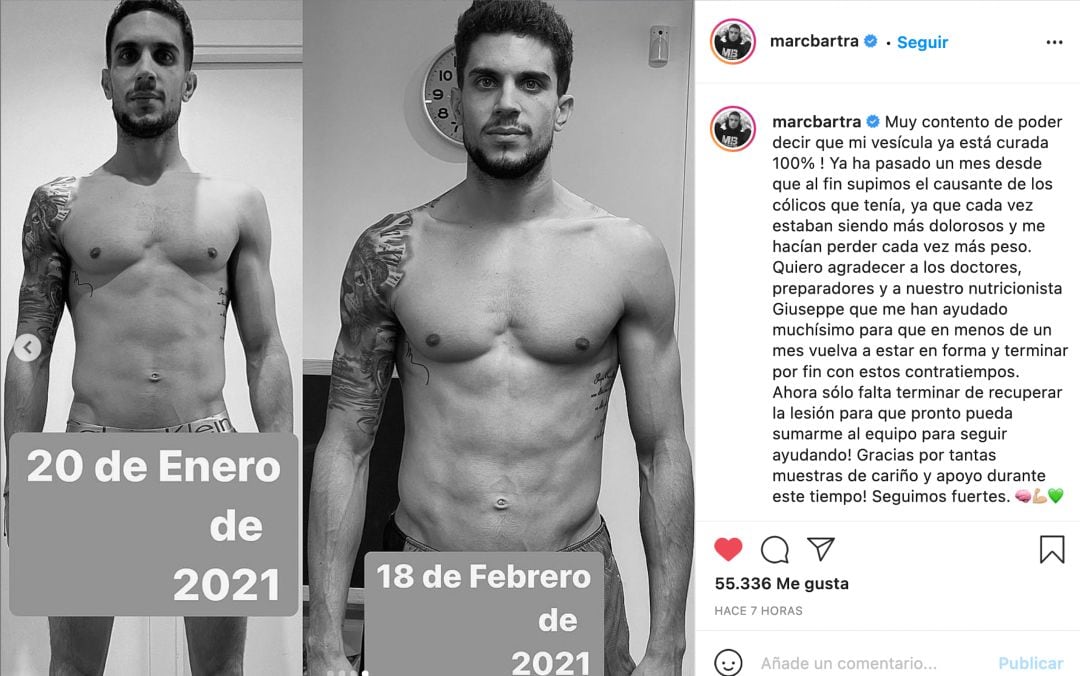 Bartra publica su estado físico en Instagram.